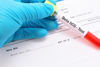 Wissenswertes zur HCG-Diät