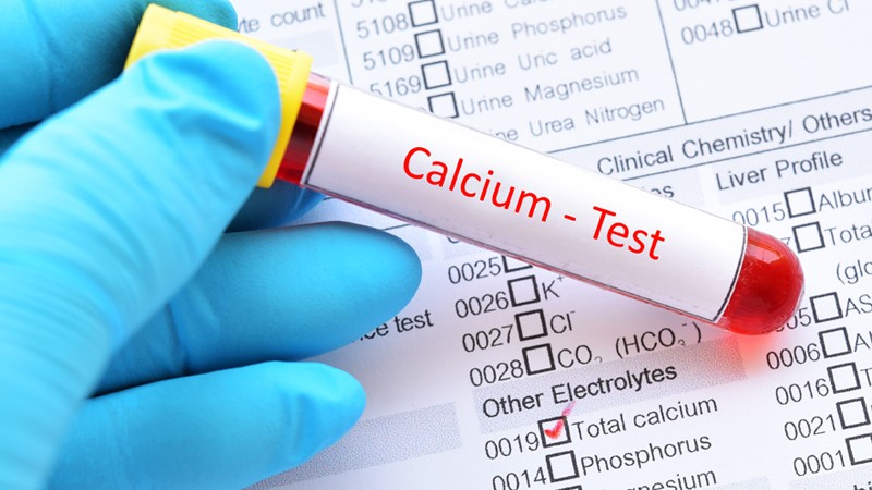 Bluttest auf Kalzium