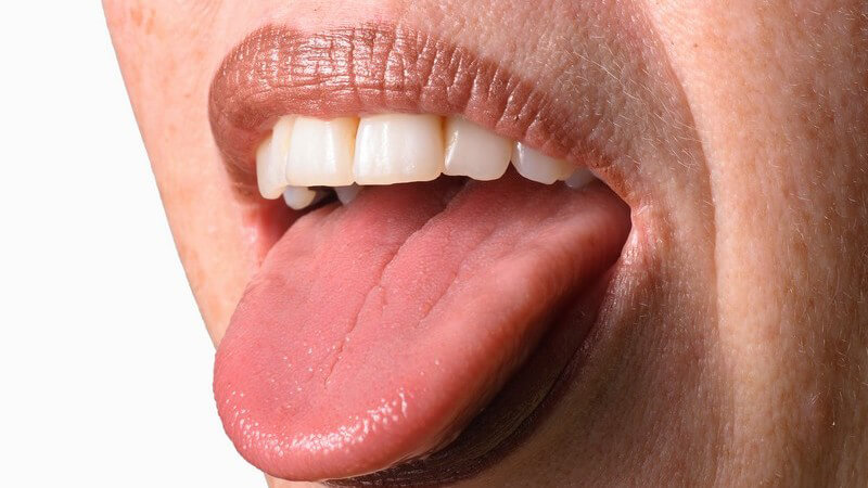 Ursachen, Symptome und Behandlung von Pickeln auf der Zunge