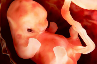 Ursachen, Folgen und Prävention einer Fehllage des Kindes