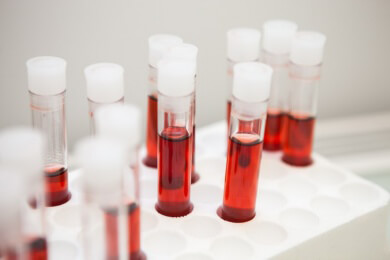 Merkmale der klinischen Studie