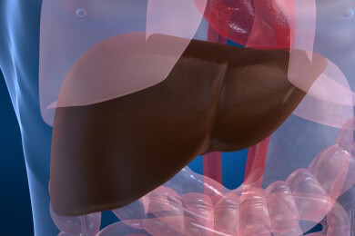 Fettleber - Ursachen, Symptome, Folgen und Behandlung