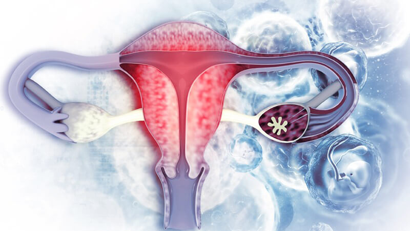 Die Entstehung von Gebärmutterhalskrebs und wie man ihn erkennen und behandeln kann