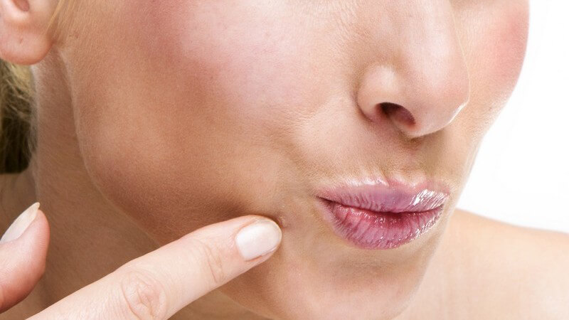 Mögliche Gründe für Hautunreinheiten nach der Pubertät und wie man sie am besten bekämpft