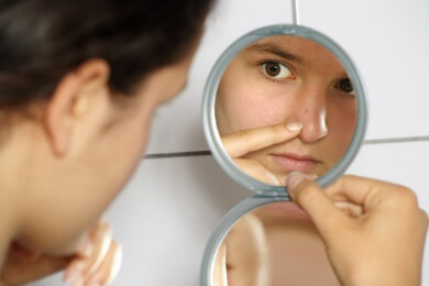 Acne vulgaris - Die gewöhnliche Akne