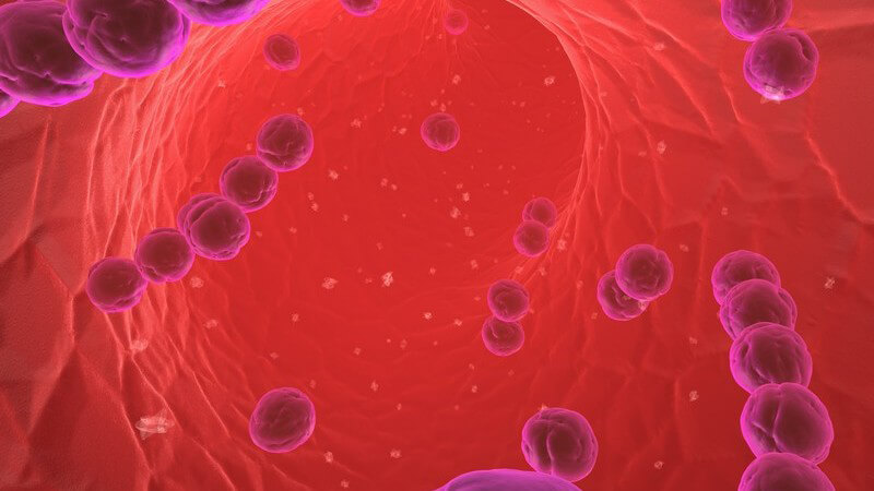 Die Entstehung einer Blutvergiftung und wie man die Schweregrade SIRS-Syndrom, schwere Sepsis und septischer Schock behandeln und erkennen kann