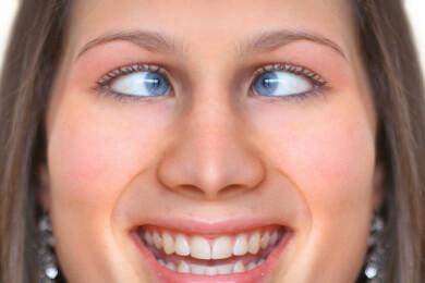 Schielen - Ursachen, Symptome, Formen und Behandlung