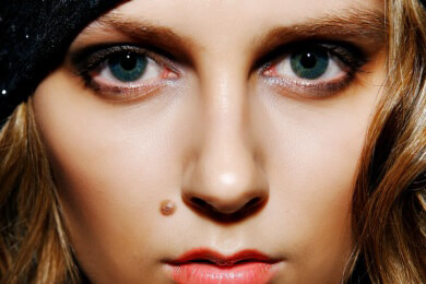 Leberflecken - harmlos oder gefährlich? Ursachen, Symptome und Behandlung