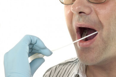 Anwendung und Ablauf des Gentests (DNA-Analyse)