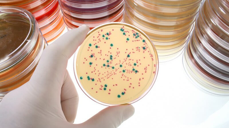 Das Anlegen einer Bakterienkultur zur genauen Untersuchung und Analyse von Bakterieninfektionen