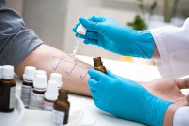 Anwendung und Ablauf des Allergietests