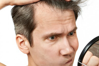 Verschiedene Möglichkeiten der Haarverdichtung und Möglichkeiten, das Haar selbst zu verdichten