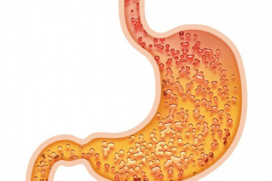Anwendung und Ablauf einer Magensaftuntersuchung