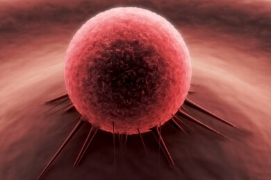 Burkitt-Lymphom - Ursachen, Symptome und Behandlung