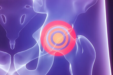 Ermüdungsbruch (Stressfraktur) - Wie kommt es dazu und welche Behandlungsmöglichkeiten gibt es?