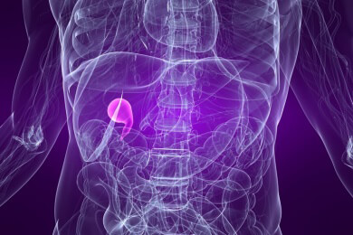 Gallenblasenkrebs - Ursachen, Symptome und Behandlung