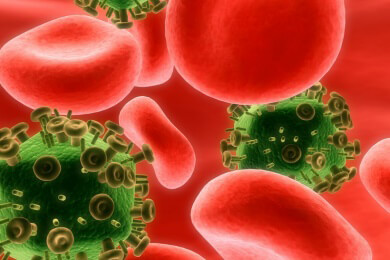 HIV-Infektion - Ursachen, Symptome und Behandlung