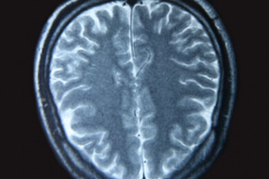 Neuroblastom - Ursachen, Symptome und Behandlung
