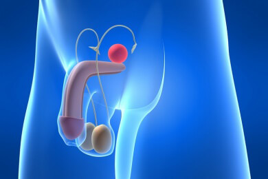 Peniskrebs - Ursachen, Symptome und Behandlung