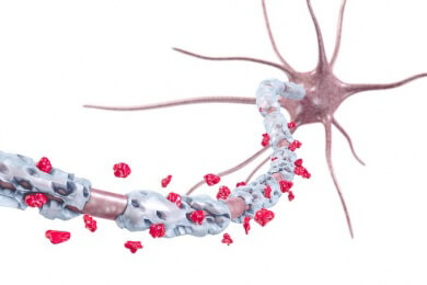 Polyneuropathie - Ursachen, Symptome und Behandlung