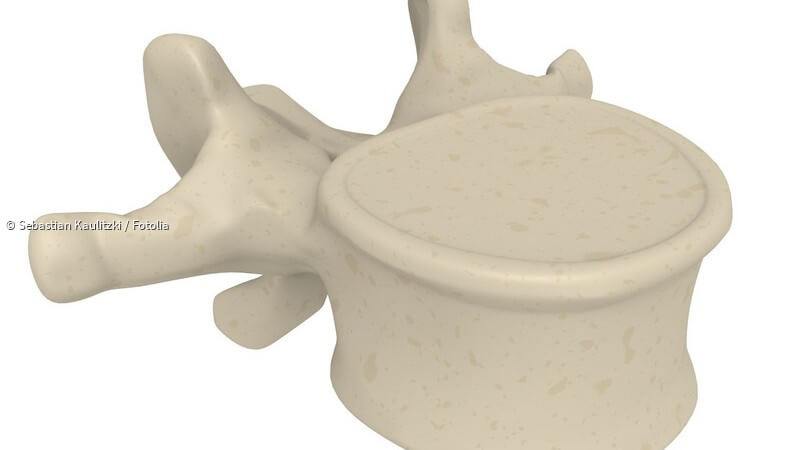 ᐅ Rachitis Ursachen, Symptome und Behandlung