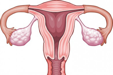 Zyste marsupialisation bartholin Bartholin Gland