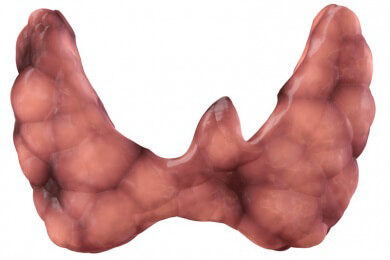 Schilddrüsenunterfunktion - Ursachen, Symptome und Behandlung
