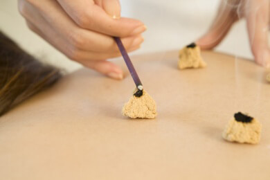 Moxibustion: Anwendung und Durchführung