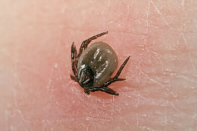 Zeckenbisse - Ursachen, Symptome, Vorbeugemöglichkeiten und das richtige Entfernen einer Zecke