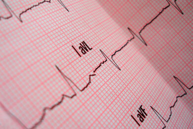 Schock - Ursachen und Behandlung
