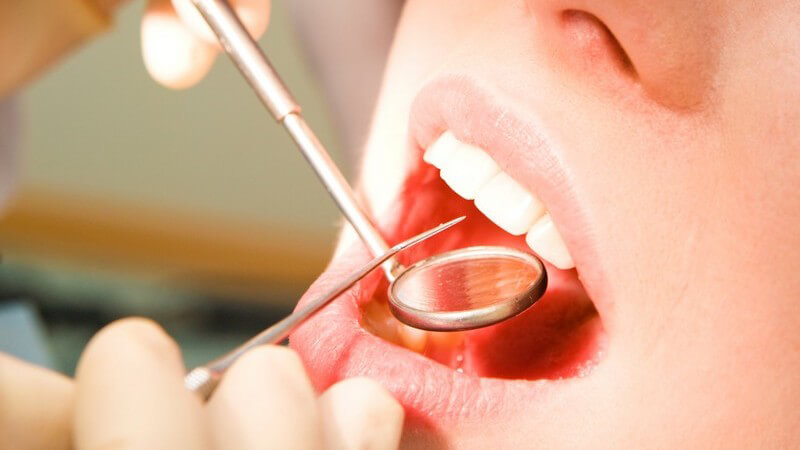 Die Entstehung von Zahnfleischbluten und wie man es behandeln und lindern kann
