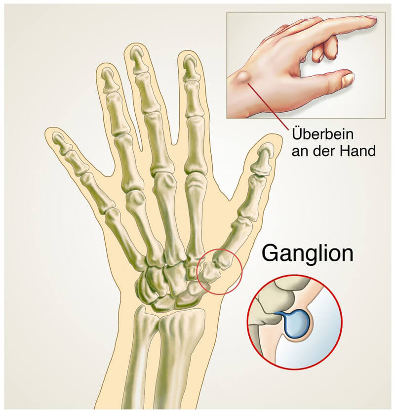 Werden meine Hände und Handgelänke größer? (Pubertät, Wachstum, Hand)