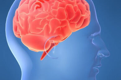 Omega-3-Fettsäuren - Nutzen und Gesundheitswert