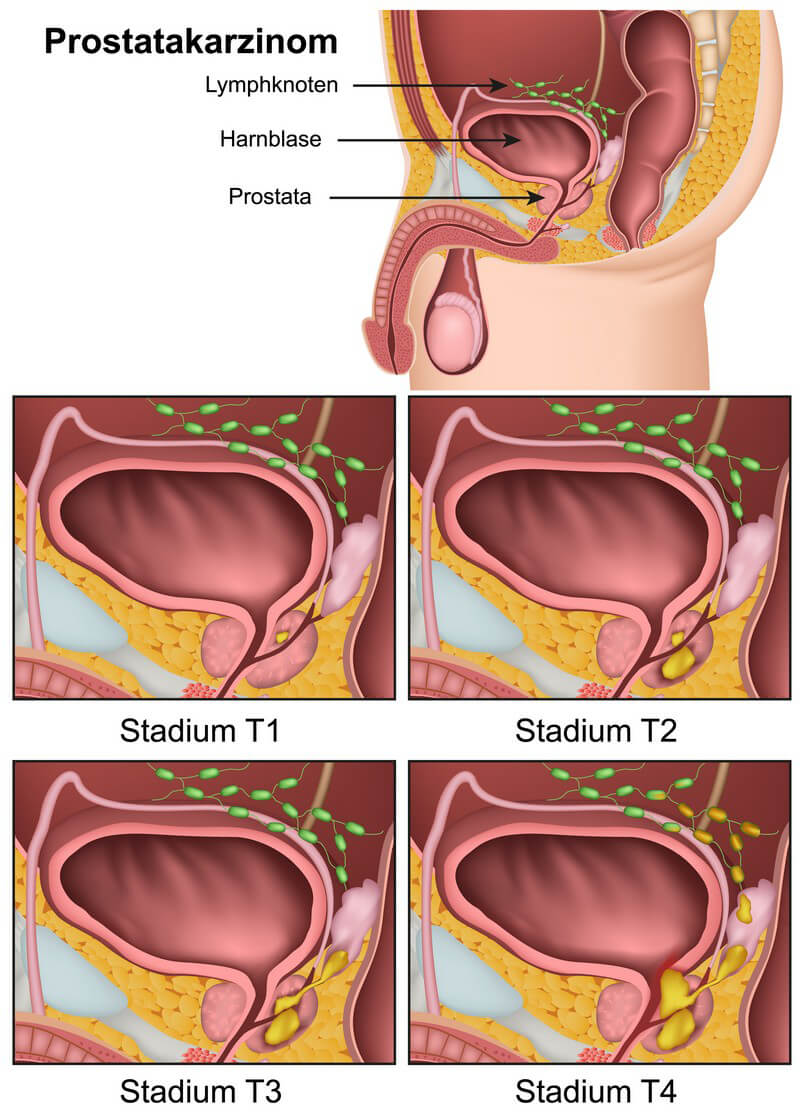 G punkt mänlicher Prostata: G