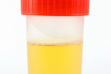 Der Urin - Wird in den Nieren gebildet und über die ableitenden Harnwege ausgeschieden