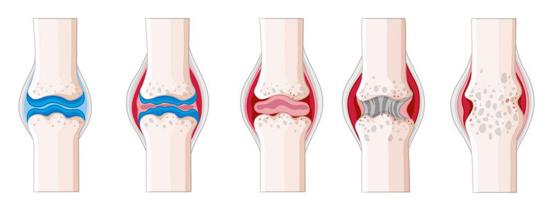 In welchen Bereichen Rheumatologen/Rheumatologinnen arbeiten und was sie machen