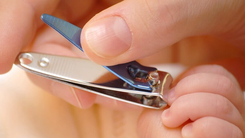 Auch Nagelscheren und Nagelzangen sollten regelmäßig gereinigt werden, um ihre Benutzung hygienisch zu machen