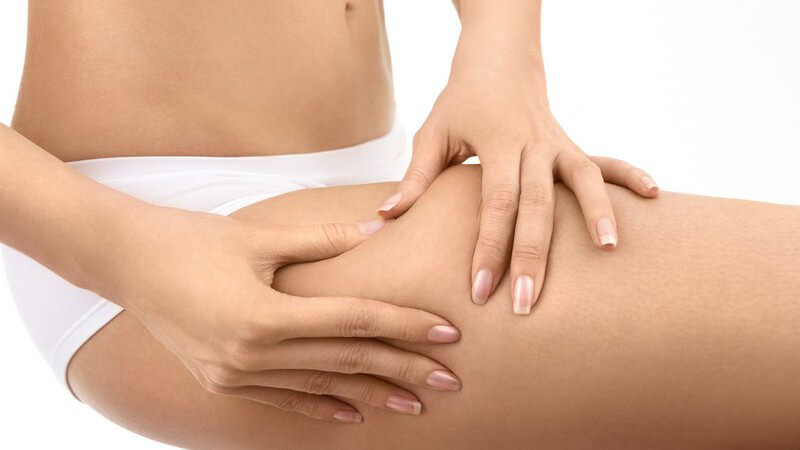 Junge Frau mit Cellulite fasst sich an Oberschenkel
