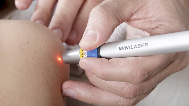 Arzt hält Minilaser auf Haut eines Patienten