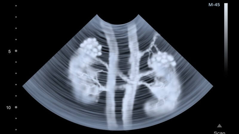 Ultraschallbild der menschlichen Nieren