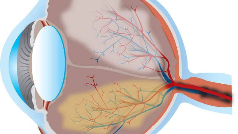 Grafik Seitenansicht menschliches Auge, Querschnitt