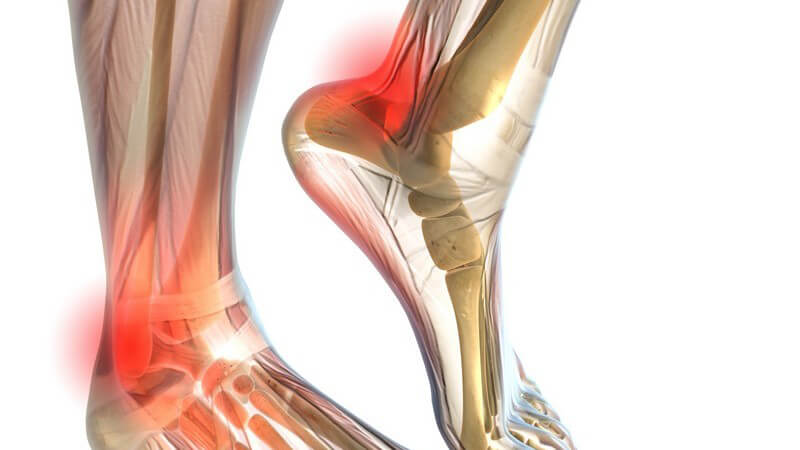 Grafik Füße rot markiert, Schmerzen am Gelenk