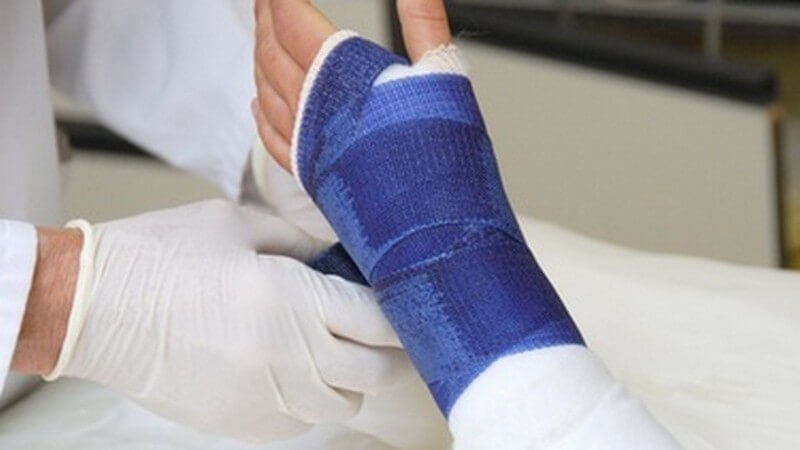 Entzündet gips sehnenscheide handgelenk Sehnenscheide Entzündet