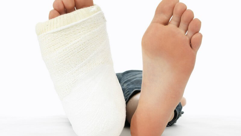 Fußsohlen und teilweise Beine von Kind, rechter Fuß in Gips