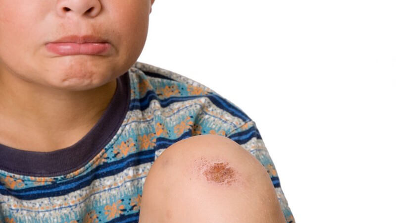 Trauriger Junge mit Schürfwunde auf Knie