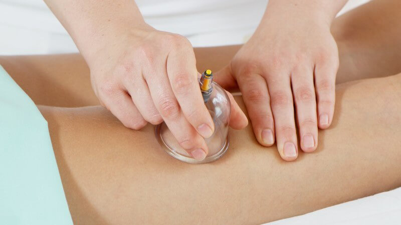 Saugnapf-Massage an Frauenbeinen