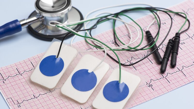 Drei Elektroden liegen auf einem Elektrokardiogramm (EKG)