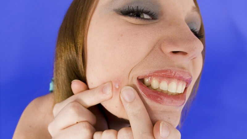 Ansicht von oben: Junge Frau drückt sich Pickel im Gesicht aus