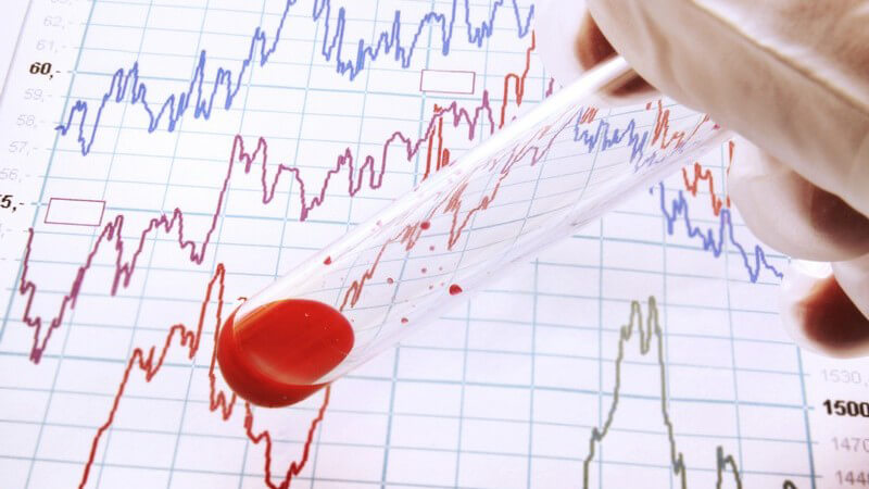 Reagenzglas mit Blutprobe über Blatt mit Testkurven
