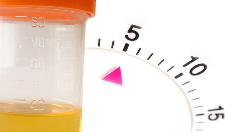 Gefäß mit Urinprobe neben Zeitanzeige, die auf fünf steht auf weißem Hintergrund